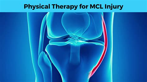 physical therapy for mcl tear